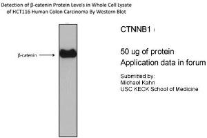 CTNNB1 antibody - N-terminal region (P100600_T100) validated by WB using HCT116 cell lysate CTNNB1 is supported by BioGPS gene expression data to be expressed in HCT116 (CTNNB1 Antikörper  (N-Term))