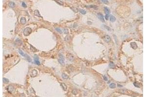 Immunohistochemical staining of formalin-fixed paraffin-embedded rat kidney tissue with PLXNB1 polyclonal antibody  at 1 : 100 dilution. (PLXNB1 Antikörper  (N-Term))