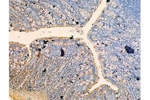 ABIN7094511 and ABIN7098560 at 1/100 staining Rat colorectal tissue by IHC-P. (SNAP23 Antikörper  (Internal Region))