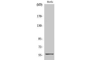 Western Blotting (WB) image for anti-Myc Proto-Oncogene protein (MYC) (C-Term) antibody (ABIN3179963) (c-MYC Antikörper  (C-Term))