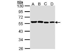 WB Image Sample (30 ug of whole cell lysate) A: A431 , B: H1299 C: Hela D: Hep G2 , 10% SDS PAGE antibody diluted at 1:1000 (TRF1 Antikörper  (C-Term))