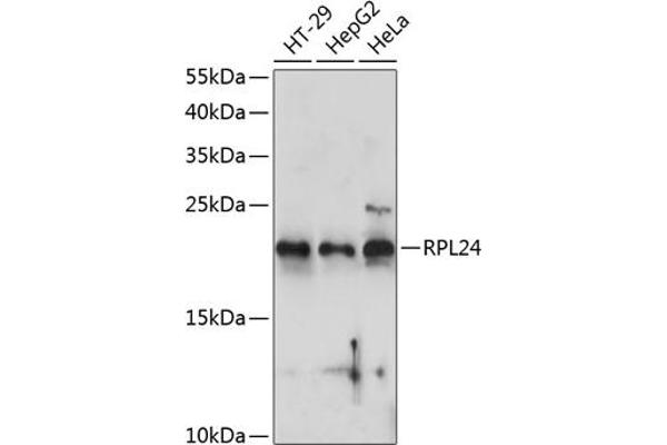 RPL24 Antikörper  (AA 38-157)