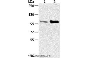 Western blot analysis of Mouse muscle and heart tissue, using ACTN2 Polyclonal Antibody at dilution of 1:300 (ACTN2 Antikörper)