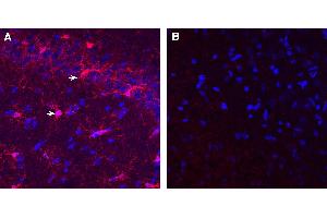 Expression of IBA1/AIF1 in rat hippocampusImmunohistochemical staining of perfusion-fixed frozen rat brain sections with Guinea Pig Anti-IBA1/AIF1 Antibody (ABIN7581823), (1:1000), followed by donkey anti-guinea pig-biotin and Streptavidin-Cy3. (Ionized Calcium-binding Adapter Molecule 1 (IBA1) Peptid)