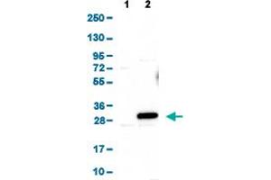 Western Blot analysis of (1) Negative control (vector only transfected HEK293T lysate), and (2) Over-expression lysate (Co-expressed with a C-terminal myc-DDK tag (~3. (ARL6 Antikörper  (AA 92-184))