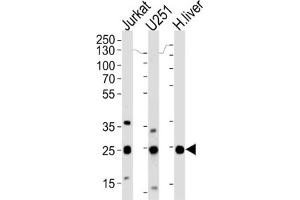 Western Blotting (WB) image for anti-Glutathione S-Transferase mu 1 (GSTM1) antibody (ABIN3002864)