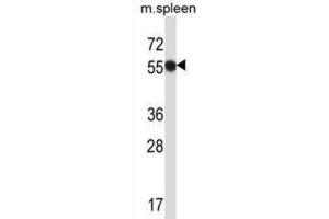 Western Blotting (WB) image for anti-Megakaryocyte-Associated tyrosine Kinase (MATK) antibody (ABIN2997860) (MATK Antikörper)