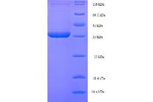 SDS-PAGE (SDS) image for Phospholysine Phosphohistidine Inorganic Pyrophosphate Phosphatase (LHPP) (AA 1-270), (full length) protein (His-SUMO Tag) (ABIN5711803)