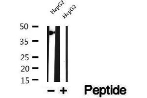 Western blot analysis of extracts of HepG2 cells, using SMYD3 antibody. (SMYD3 Antikörper  (N-Term))
