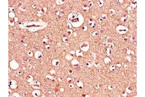 Immunohistochemistry of paraffin-embedded human brain tissue using ABIN7159770 at dilution of 1:100 (MAPT Antikörper  (AA 33-166))