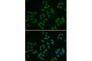 Immunofluorescence (IF) image for anti-Tumor Protein P63 (TP63) (AA 421-680) antibody (ABIN6219346) (p63 Antikörper  (AA 421-680))
