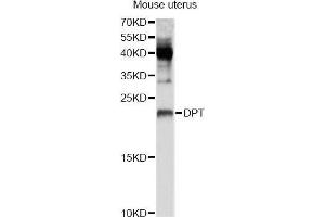 Western blot analysis of extracts of mouse uterus, using DPT Antibody (ABIN5995761) at 1/1000 dilution. (Dermatopontin Antikörper)