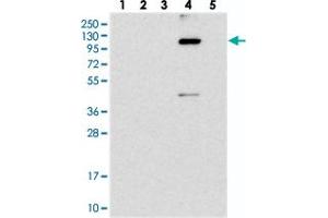 Western blot analysis of Lane 1: RT-4, Lane 2: U-251 MG, Lane 3: Human Plasma, Lane 4: Liver, Lane 5: Tonsil with KIAA1468 polyclonal antibody . (KIAA1468 Antikörper)
