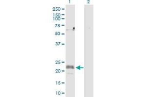 Western Blot analysis of CFC1 expression in transfected 293T cell line by CFC1 MaxPab polyclonal antibody. (CFC1 Antikörper  (AA 1-223))