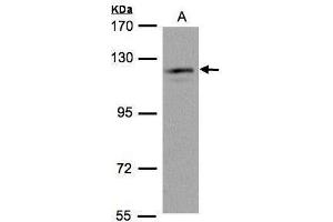 WB Image Sample(30 μg of whole cell lysate) A:HeLa S3, 7. (USP11 Antikörper  (N-Term))