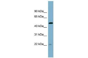 UCHL5IP antibody used at 1 ug/ml to detect target protein. (HAUS7 Antikörper  (Middle Region))