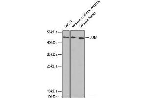 Western blot analysis of extracts of various cell lines using LUM Polyclonal Antibody at dilution of 1:1000. (LUM Antikörper)