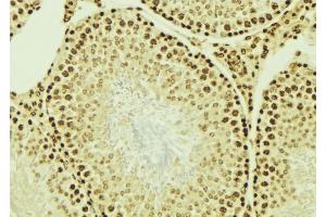 ABIN6276701 at 1/100 staining Mouse testis tissue by IHC-P. (IGF2BP1 Antikörper  (N-Term))