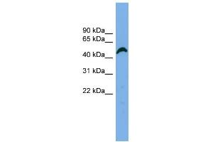 Western Blotting (WB) image for anti-Amyloid beta (A4) Precursor Protein-Binding, Family B, Member 3 (APBB3) (N-Term) antibody (ABIN2784982)
