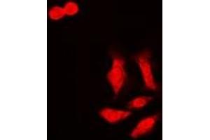 Immunofluorescent analysis of HCCR-1 staining in MCF7 cells.
