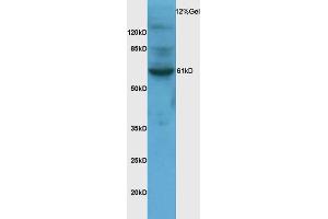 Rat brain lysates probed with Anti-SNX1 Polyclonal Antibody (ABIN682078) at 1:200 in 4 °C. (Sorting Nexin 1 Antikörper  (AA 401-522))