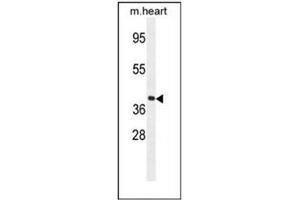 Western blot analysis of GNA15 Antibody (C-term) in mouse heart tissue lysates (35ug/lane).