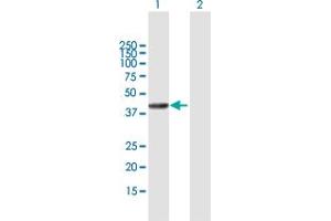 Western Blot analysis of SETMAR expression in transfected 293T cell line by SETMAR MaxPab polyclonal antibody.