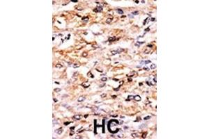 Immunohistochemistry (Paraffin-embedded Sections) (IHC (p)) image for anti-Eukaryotic Translation Initiation Factor 2 alpha Kinase 4 (EIF2AK4) (AA 1-30), (N-Term) antibody (ABIN391197)