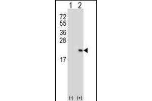 Western blot analysis of RFK (arrow) using rabbit polyclonal RFK Antibody (C15) (ABIN391271 and ABIN2841321). (Riboflavin Kinase Antikörper  (N-Term))