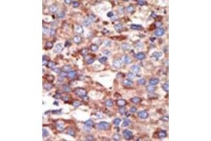Image no. 2 for anti-YY1 Transcription Factor (YY1) (Middle Region) antibody (ABIN357757) (YY1 Antikörper  (Middle Region))