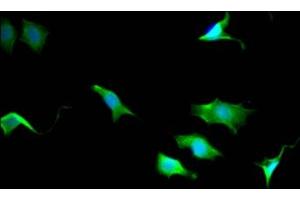 Immunofluorescence staining of SY5Y Cells with ABIN7127838 at 1:50, counter-stained with DAPI. (Rekombinanter TPT1 Antikörper)