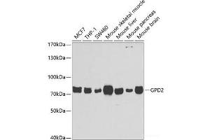 Western blot analysis of extracts of various cell lines using GPD2 Polyclonal Antibody at dilution of 1:1000. (GPD2 Antikörper)