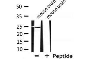 Western blot analysis of extracts from mouse brain, using EFNA2 Antibody. (Ephrin A2 Antikörper  (N-Term))