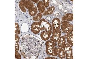Immunohistochemical staining of human kidney with FBXO43 polyclonal antibody  shows distinct cytoplasmic positivity in cells in tubules. (FBXO43 Antikörper)