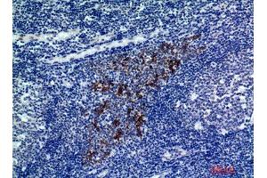 Immunohistochemistry (IHC) analysis of paraffin-embedded Human Tonsils, antibody was diluted at 1:200. (CMTM8 Antikörper)