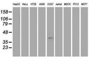 Image no. 1 for anti-Musashi Homolog 1 (Drosophila) (MSI1) antibody (ABIN1499571)