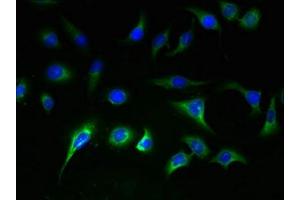 Immunofluorescent analysis of A549 cells using ABIN7170191 at dilution of 1:100 and Alexa Fluor 488-congugated AffiniPure Goat Anti-Rabbit IgG(H+L) (SLC25A36 Antikörper  (AA 58-110))