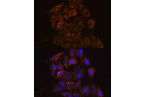 Immunofluorescence analysis of C6 cells using UPF1/RENT1 Rabbit mAb (ABIN7271226) at dilution of 1:100 (40x lens). (RENT1/UPF1 Antikörper)