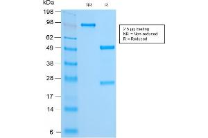 SDS-PAGE Analysis Purified FOXA1 Rabbit Recombinant Monoclonal Antibody (FOXA1/2230R). (Rekombinanter FOXA1 Antikörper  (AA 372-472))