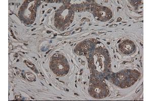 Immunohistochemical staining of paraffin-embedded breast using anti-CPA1 (ABIN2452540) mouse monoclonal antibody.