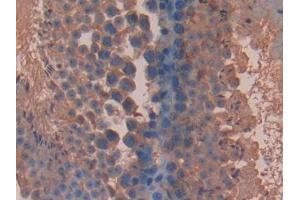 DAB staining on IHC-P; Samples: Mouse Testis Tissue (BLMH Antikörper  (AA 27-164))