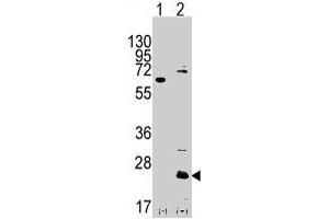 Western blot analysis of CD9 (arrow) using rabbit CD9 polyclonal antibody . (CD9 Antikörper  (N-Term))