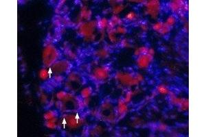 Expression of TrkA in rat DRG - Immunohistochemical staining of rat dorsal root ganglia (DRG) frozen sections using Anti-TrkA (extracellular) Antibody (ABIN7043385, ABIN7044771 and ABIN7044772), (1:100). (TRKA Antikörper  (2nd Extracellular Domain))