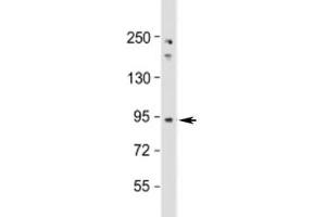 Western blot testing of human Jurkat cell lysate with NUP93 antibody at 1:1000. (NUP93 Antikörper  (AA 752-782))