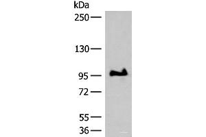 Western blot analysis of TM4 cell lysate using GANC Polyclonal Antibody at dilution of 1:550