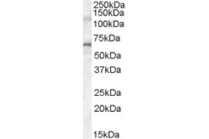 Image no. 1 for anti-Interleukin-1 Receptor-Associated Kinase 3 (IRAK3) (C-Term), (Internal Region) antibody (ABIN375025) (IRAK3 Antikörper  (C-Term, Internal Region))