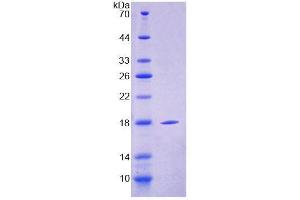SDS-PAGE analysis of Mouse CLEC4L Protein. (DC-SIGN/CD209 Protein)