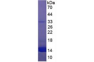 SDS-PAGE (SDS) image for Hemoglobin protein (ABIN1980590) (Hemoglobin Protein)