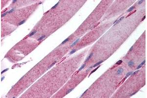 Human Skeletal Muscle (formalin-fixed, paraffin-embedded) stained with KALRN antibody ABIN213945 at 5 ug/ml followed by biotinylated goat anti-rabbit IgG secondary antibody ABIN481713, alkaline phosphatase-streptavidin and chromogen. (KALRN Antikörper  (AA 1591-1605))