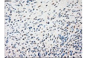 Immunohistochemical staining of paraffin-embedded lung tissue using anti-SSBmouse monoclonal antibody. (SSB Antikörper)